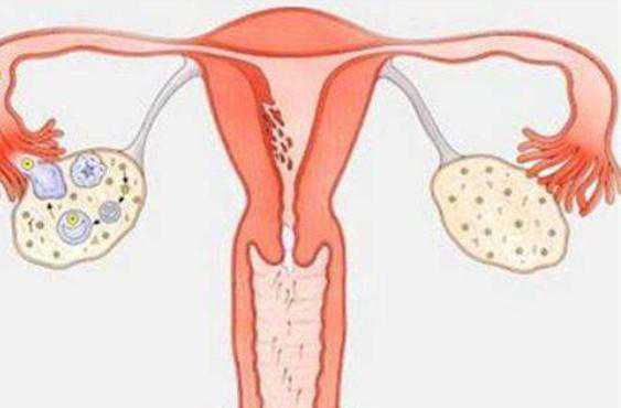 试管助孕供卵试管剖腹产正确起床的方法