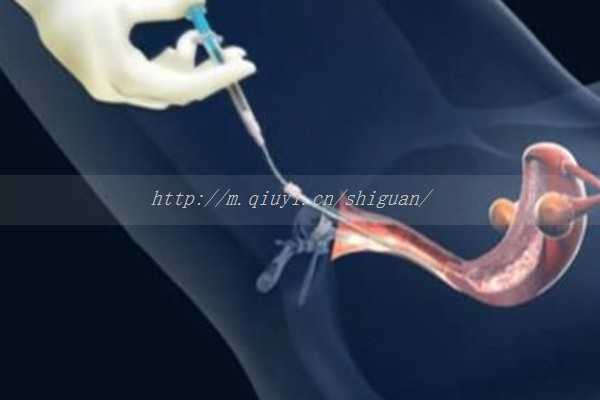 [专业助孕公司]宿州助孕公司供卵怀孕多少钱